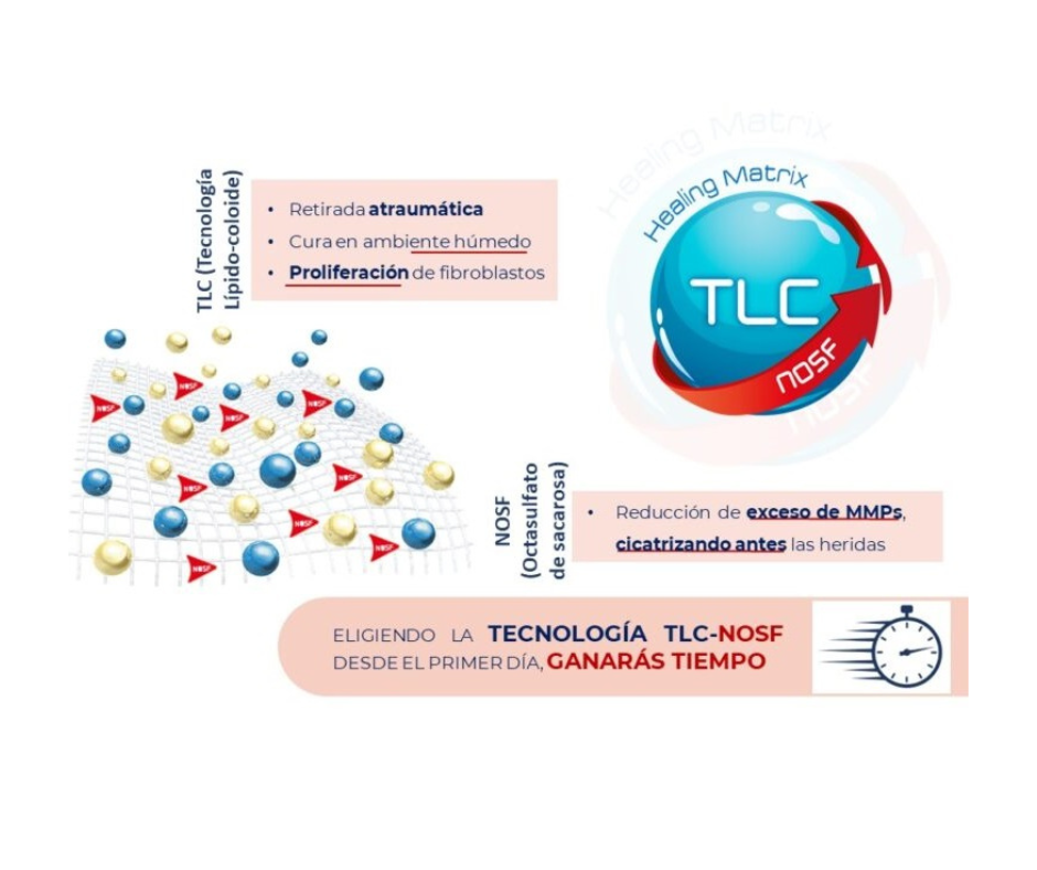 Fibras con TLC.-NOSF